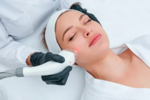 laser skin treatment mahopac ny