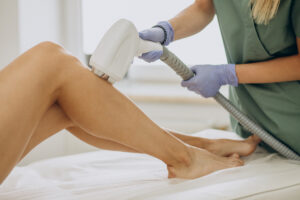 A woman's legs and a technician performing laser epilation hair removal
