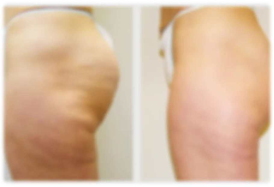 Before and After Results